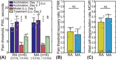 Influence of acupuncture intensity on analgesic effects in AA rat models